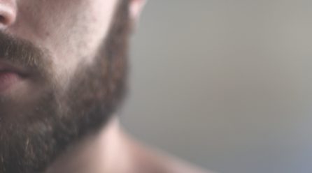 Pánske problémy s pleťou? Existuje riešenie!